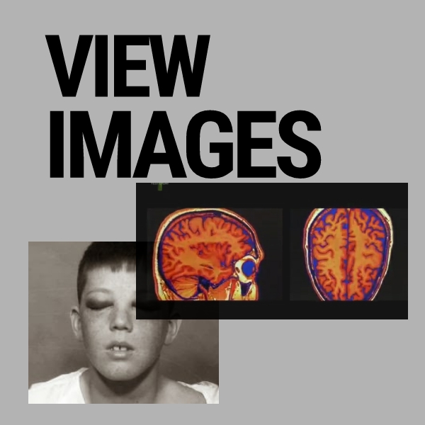 View images of lobotomy, brain scans, medical records